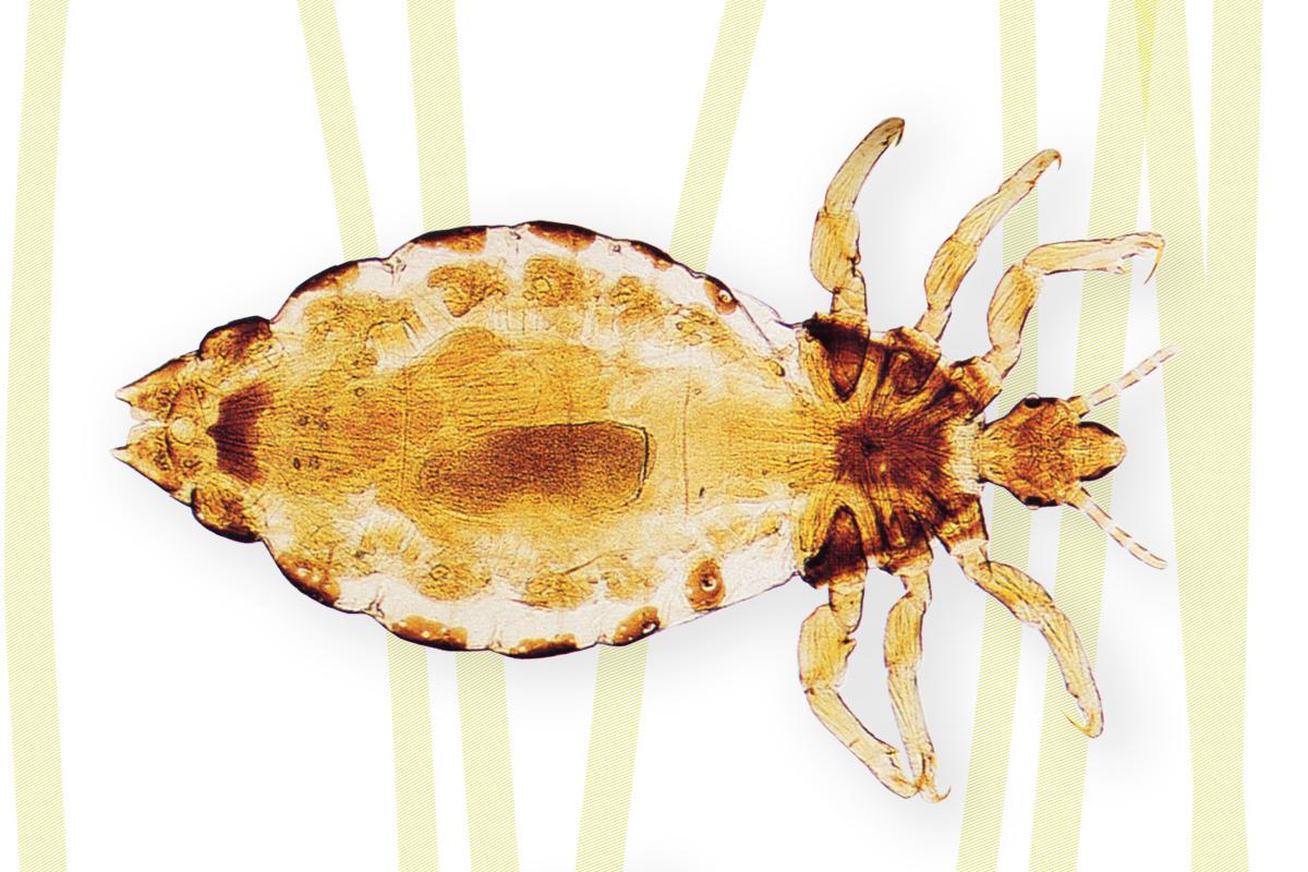 Menschenlaus (Pediculus humanus)