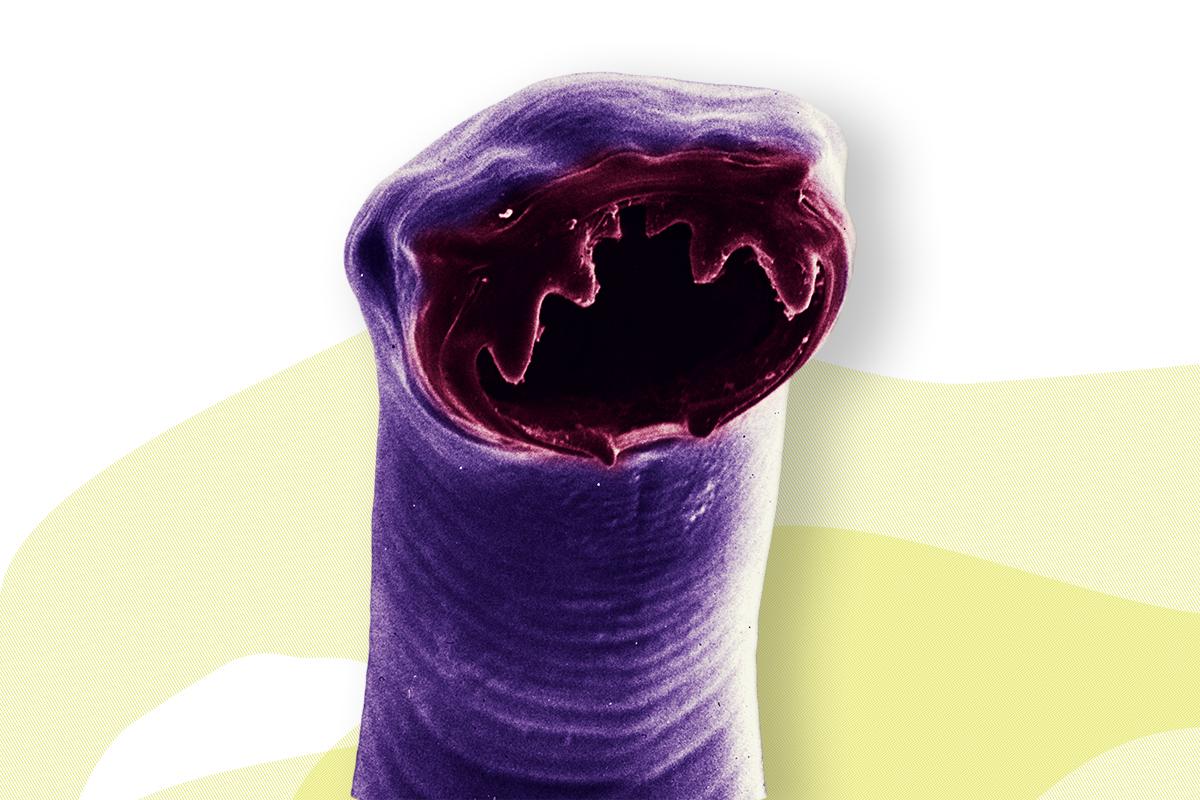 Kopf des Hakenwurms (Ancylostoma) mit Mundwerkzeugen Foto: Prof. Dr. H. Mehlhorn, Heinrich Heine Universität Düsseldorf