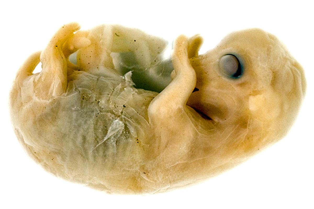 Embryo eines Hausschafs Ovis aries, Foto: Hwa Ja Götz, MfN Embryo eines Hausschafs Ovis aries, Foto: Hwa Ja Götz, MfN